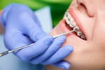 10 Proven Tips To Find The Best Orthodontists In Sacramento
