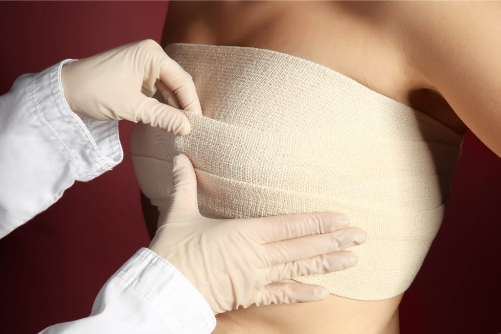 5 Post Breast Augmentation Tips