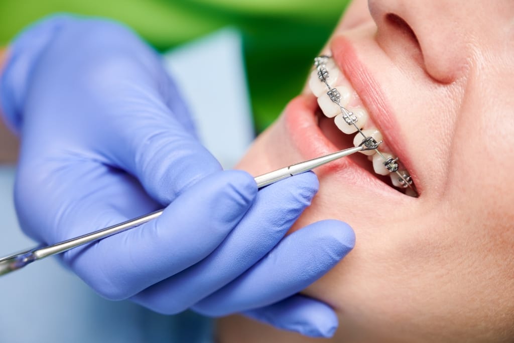 Top 10 Questions You Must Ask Before Choosing An Orthodontist