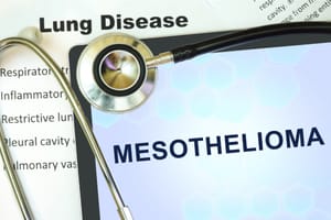 10 Things You Need To Know About Mesothelioma
