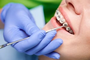 10 Proven Tips To Find The Best Orthodontists In Sacramento