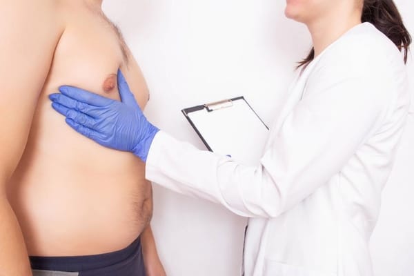 5 Benefits Of Getting Gynecomastia Surgery