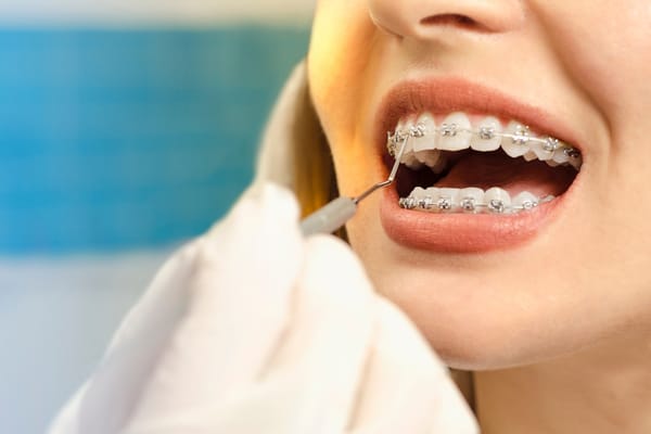 10 Tips For Financing Teeth Braces